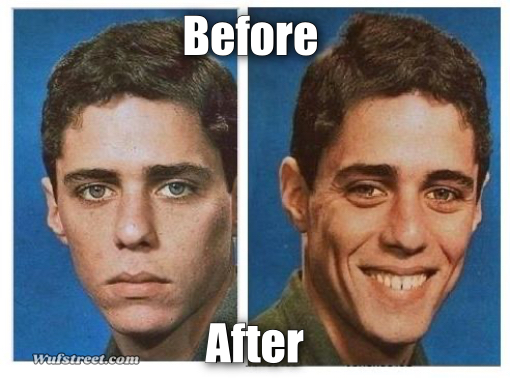 before after - sad happy face