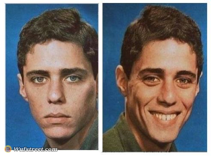 before after - sad happy face